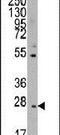T-cell surface glycoprotein CD8 beta chain antibody, PA5-11496, Invitrogen Antibodies, Western Blot image 