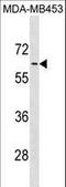 Adrenoceptor Alpha 1B antibody, LS-C157538, Lifespan Biosciences, Western Blot image 