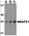 B Cell Receptor Associated Protein 31 antibody, orb87292, Biorbyt, Western Blot image 