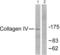 Collagen Type IV Alpha 1 Chain antibody, abx013045, Abbexa, Western Blot image 