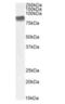 Protein Kinase C Beta antibody, orb403010, Biorbyt, Western Blot image 