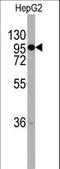 Chordin antibody, LS-B8994, Lifespan Biosciences, Western Blot image 