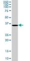 Ankyrin Repeat Family A Member 2 antibody, H00057763-D01P, Novus Biologicals, Western Blot image 