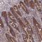 Deoxythymidylate Kinase antibody, HPA042719, Atlas Antibodies, Immunohistochemistry frozen image 