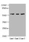 Interferon Induced Protein With Tetratricopeptide Repeats 5 antibody, CSB-PA011023LA01HU, Cusabio, Western Blot image 