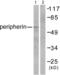 Peripherin antibody, LS-C827149, Lifespan Biosciences, Western Blot image 