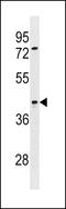 Signal Regulatory Protein Beta 2 antibody, LS-C158972, Lifespan Biosciences, Western Blot image 