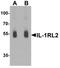 Interleukin 1 Receptor Like 2 antibody, TA326663, Origene, Western Blot image 