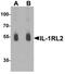 Interleukin 1 Receptor Like 2 antibody, TA326663, Origene, Western Blot image 