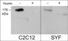 Roundabout Guidance Receptor 2 antibody, RP2861, ECM Biosciences, Western Blot image 