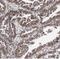 Probable DNA dC->dU-editing enzyme APOBEC-3C antibody, FNab00494, FineTest, Immunohistochemistry paraffin image 