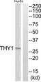 Thy-1 Cell Surface Antigen antibody, abx015184, Abbexa, Western Blot image 