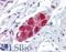 Transient Receptor Potential Cation Channel Subfamily V Member 2 antibody, LS-B4211, Lifespan Biosciences, Immunohistochemistry paraffin image 