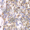 ATP Synthase F1 Subunit Alpha antibody, A5884, ABclonal Technology, Immunohistochemistry paraffin image 