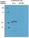 RuvB Like AAA ATPase 2 antibody, GTX77831, GeneTex, Western Blot image 