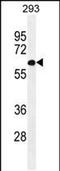 PAT1 Homolog 2 antibody, PA5-48187, Invitrogen Antibodies, Western Blot image 