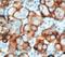 Mucin 16, Cell Surface Associated antibody, LS-C311949, Lifespan Biosciences, Immunohistochemistry frozen image 