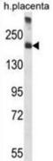 Alpha-2-Macroglobulin antibody, abx028309, Abbexa, Western Blot image 