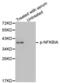 NFKB Inhibitor Alpha antibody, abx000467, Abbexa, Western Blot image 