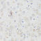 Acetylcholine Receptor antibody, LS-C747448, Lifespan Biosciences, Immunohistochemistry paraffin image 