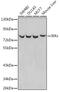 Inhibitor Of Nuclear Factor Kappa B Kinase Subunit Epsilon antibody, GTX55673, GeneTex, Western Blot image 