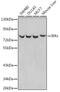 Inhibitor Of Nuclear Factor Kappa B Kinase Subunit Epsilon antibody, GTX55673, GeneTex, Western Blot image 