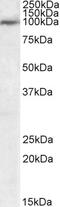 Ubiquitin Specific Peptidase 20 antibody, 46-558, ProSci, Western Blot image 