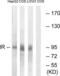 Insulin Receptor antibody, LS-C117656, Lifespan Biosciences, Western Blot image 
