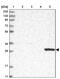 CTD Nuclear Envelope Phosphatase 1 antibody, PA5-57951, Invitrogen Antibodies, Western Blot image 
