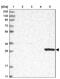 CTD Nuclear Envelope Phosphatase 1 antibody, PA5-57951, Invitrogen Antibodies, Western Blot image 