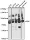 Glucosamine (UDP-N-Acetyl)-2-Epimerase/N-Acetylmannosamine Kinase antibody, GTX65984, GeneTex, Western Blot image 