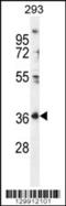 IZUMO1 Receptor, JUNO antibody, 56-160, ProSci, Western Blot image 