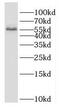 Dihydropyrimidinase antibody, FNab02526, FineTest, Western Blot image 
