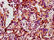 Heat Shock Protein Family B (Small) Member 1 antibody, CSB-RA010833A78phHU, Cusabio, Immunohistochemistry frozen image 