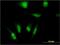 Transcription initiation factor TFIID subunit 7-like antibody, H00054457-M04, Novus Biologicals, Immunofluorescence image 