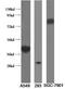 Interleukin 1 Receptor Like 1 antibody, 11920-1-AP, Proteintech Group, Western Blot image 