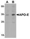 Apolipoprotein E antibody, A00015-1, Boster Biological Technology, Western Blot image 