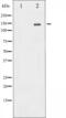 c-met antibody, abx011905, Abbexa, Western Blot image 