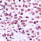 Myeloid Zinc Finger 1 antibody, LS-C353013, Lifespan Biosciences, Immunohistochemistry frozen image 