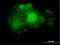 Aldolase, Fructose-Bisphosphate A antibody, H00000226-M02, Novus Biologicals, Immunofluorescence image 