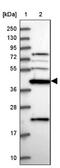 Creatine Kinase, Mitochondrial 1B antibody, NBP2-13840, Novus Biologicals, Western Blot image 