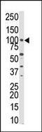 Protein Kinase N3 antibody, PA5-15127, Invitrogen Antibodies, Western Blot image 