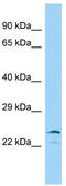 Iodotyrosine Deiodinase antibody, TA334075, Origene, Western Blot image 