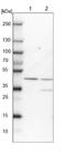 Required For Meiotic Nuclear Division 5 Homolog B antibody, NBP2-13234, Novus Biologicals, Western Blot image 