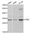 Cathepsin H antibody, A5368, ABclonal Technology, Western Blot image 