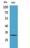 Voltage Dependent Anion Channel 1 antibody, STJ96755, St John