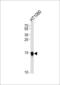 Interferon Induced Transmembrane Protein 3 antibody, MBS9201518, MyBioSource, Western Blot image 