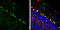 Calcitonin gene-related peptide 1 antibody, GTX134005, GeneTex, Immunohistochemistry frozen image 