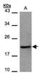 Baculoviral IAP Repeat Containing 5 antibody, GTX100441, GeneTex, Western Blot image 
