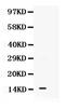 S100 Calcium Binding Protein A11 antibody, PB9818, Boster Biological Technology, Western Blot image 